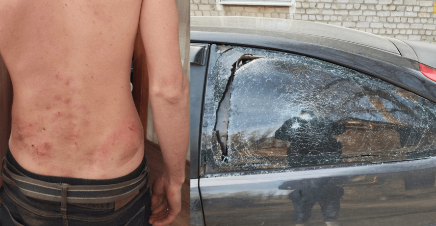 В Воронеже пьяный мужчина напал с монтировкой на прохожего и покусал его мать
